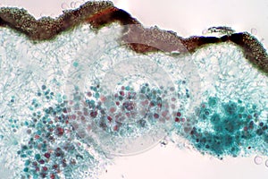 Lichen, Fungus, cross section slide under the light microscope view