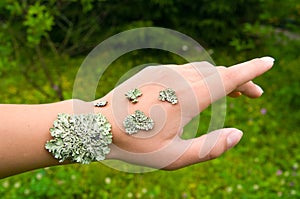 Lichen on the hand