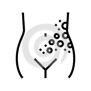 lichen shingles disease line icon vector illustration photo