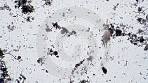 The life of rotifers in dirty environment of microscopic background