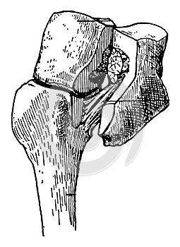 Ligament of Lisfranc, vintage illustration