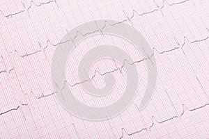 Light heartbeat cardiogram background, close-up