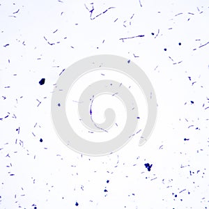 Light micrograph of bacteria Bacillus anthracis