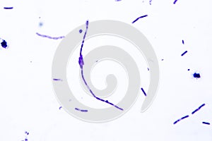 Light micrograph of bacteria Bacillus anthracis
