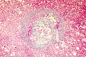 Light micrograph of a fatty liver