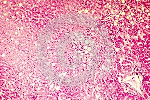 Light micrograph of a fatty liver photo