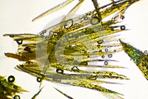 Light micrograph of fragile clonal leaves of pincushion moss