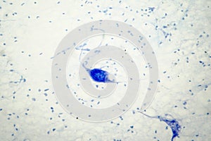 Light micrograph of human brain tissue showing neurons and glial cells