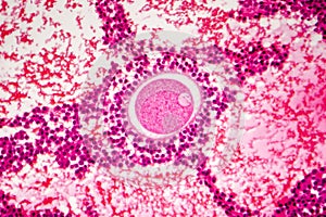 Light micrograph of human ovary