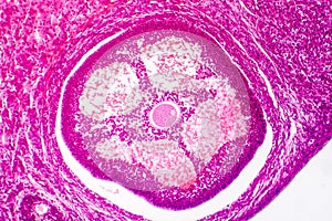 Light micrograph of human ovary photo