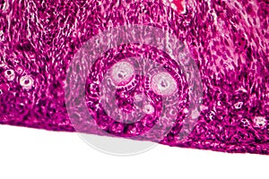 Light micrograph of human ovary