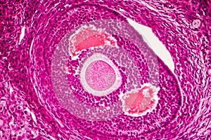 Light micrograph of human ovary photo