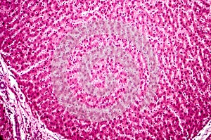 Light micrograph of a liver
