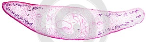 Light micrograph of a liver fluke Fasciola hepatica