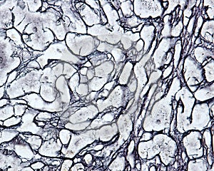 Human liver. Reticular fibers photo