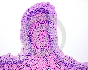 Urinary bladder. Transitional epithelium