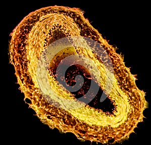 Light micrograph of a muscular artery