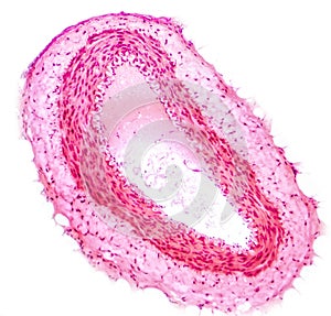 Light micrograph of a muscular artery photo