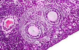 Light micrograph of ovary