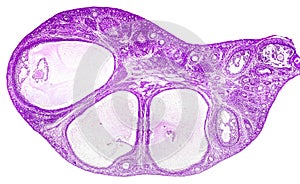 Light micrograph of ovary