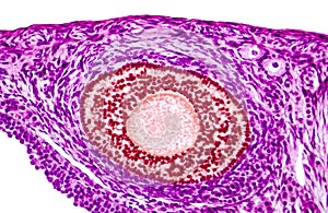 Light micrograph of ovary