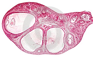 Light micrograph of ovary photo