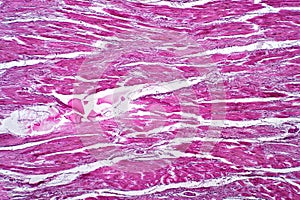 Light microscope Cardiac callosity pathplogy