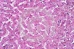 Light microscope Hepatic hemosiderosis of liver pathology