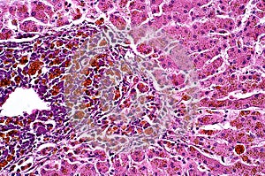 Light microscope Pigmentary of liver pathology photo