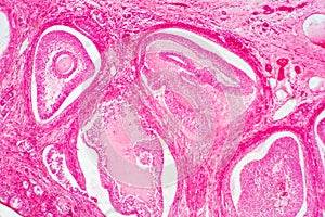 Light microscopic of human ovary showing primary and secondary follicles