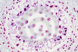 Lily anther cross section seen through microscope for education photo