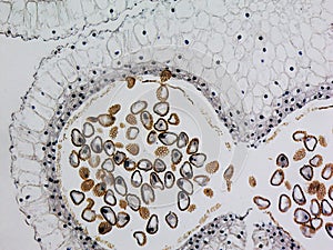 Lily anther micrograph photo