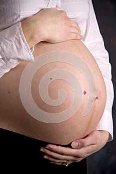 Linea Nigra Pregnancy photo