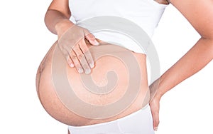 Linea nigra and stretch marks on pregnant women photo