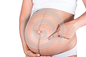 Linea nigra and stretch marks pregnant women photo