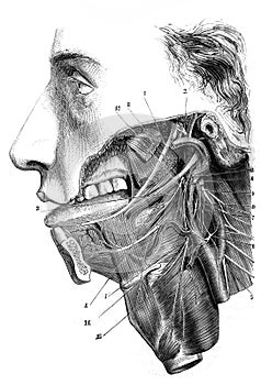 Lingual nerve, pharyngeal glosso and others in the old book D`Anatomie Chirurgicale, by B. Anger, 1869, Paris