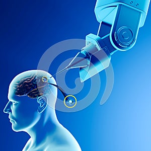 Link, neuralink, new artificial intelligence technology that allows you to connect to the human brain.
