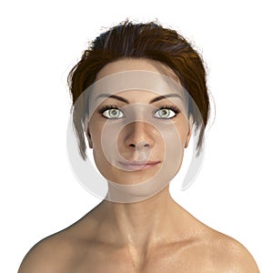 Lip augmentation, illustration showing lips in female before procedure