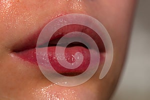 Lip balm. Lipcare lipstick. Close-up of sexy lips. Gloss makeup. Filler Injections, Plastic Surgery, Collagen and