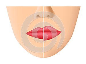 Lip and mouth skin filler vector