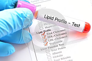 Lipid profile test