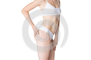 Liposuction, fat and cellulite removal concept, overweight female body with painted lines and arrows
