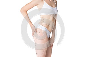 Liposuction, fat and cellulite removal concept, overweight female body with painted lines and arrows photo