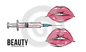 Lips injection makeup art, lip fillers, hyaluronic acid vector art  mouth underskin cosmetic