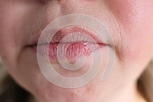 Lips, mouth and chin of a middle-aged woman, part of the face close-up, fine wrinkles on the face, spots, the concept of cosmetic