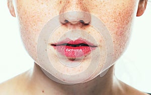 Lips and nose woman freckle happy young beautiful studio portrait with healthy skin photo
