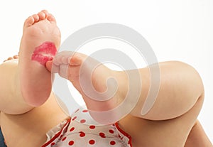 Lipstick kiss on newborn