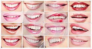 Lipsticks. Set of Women's Lips. Toothy Smiles photo