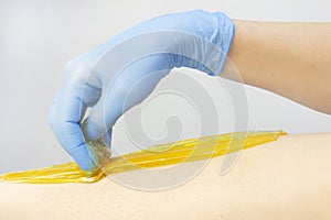 Liquid sugar for skin epilation. Close up shot. Beautician waxing female legs