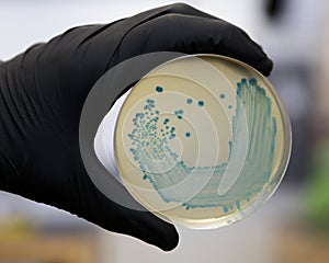 Listeria monocytogenes on agar